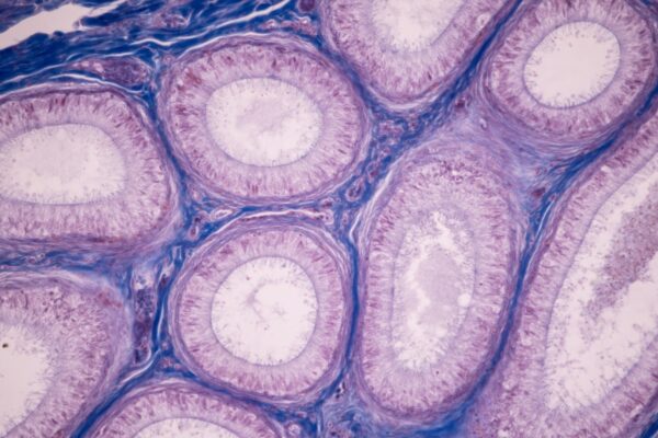 Menopause Self Care: A Somatic & Shamanic Approach - Image 2